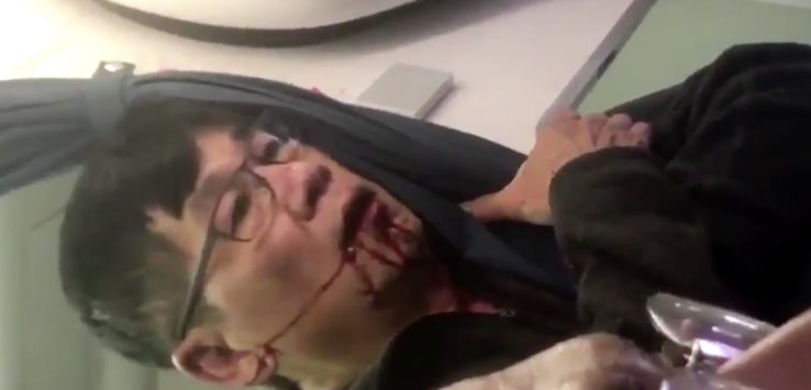 United CEO on Bloodied Passenger
