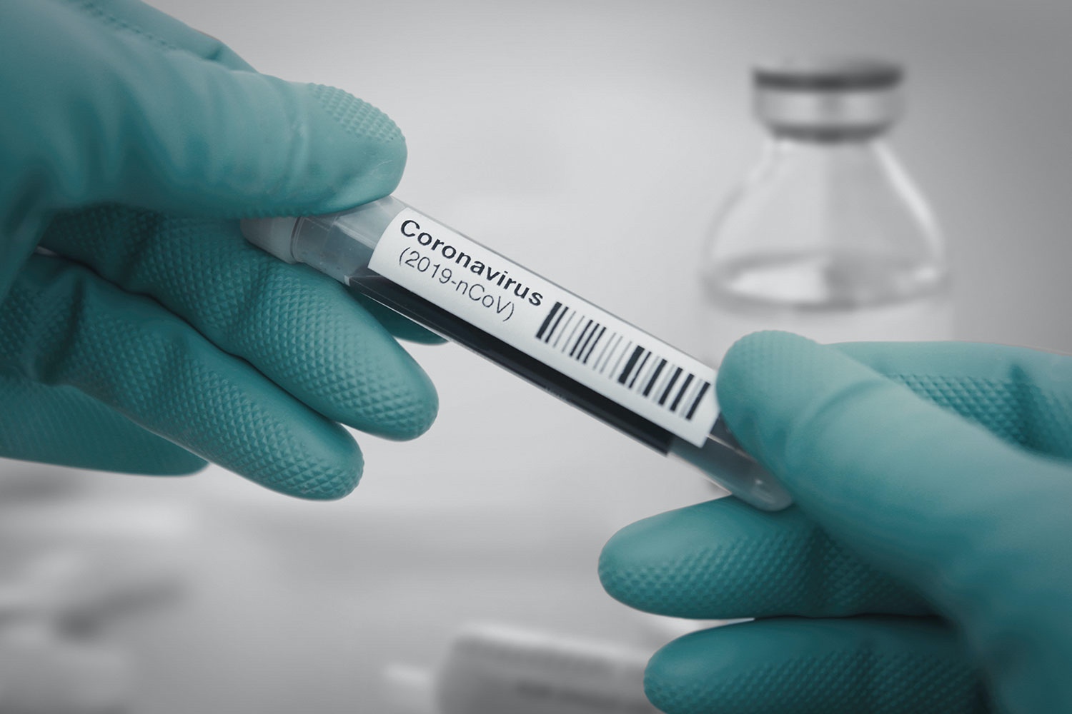 a person holding a test tube with a bar code label