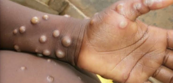 a close-up of a person's hand