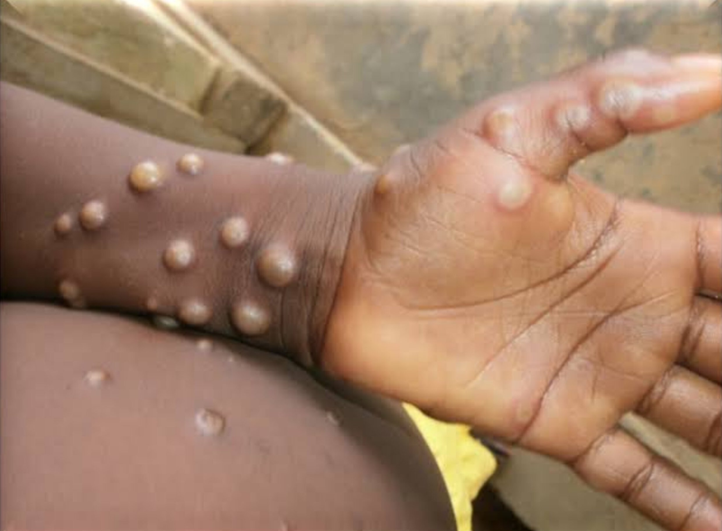 a close-up of a person's hand