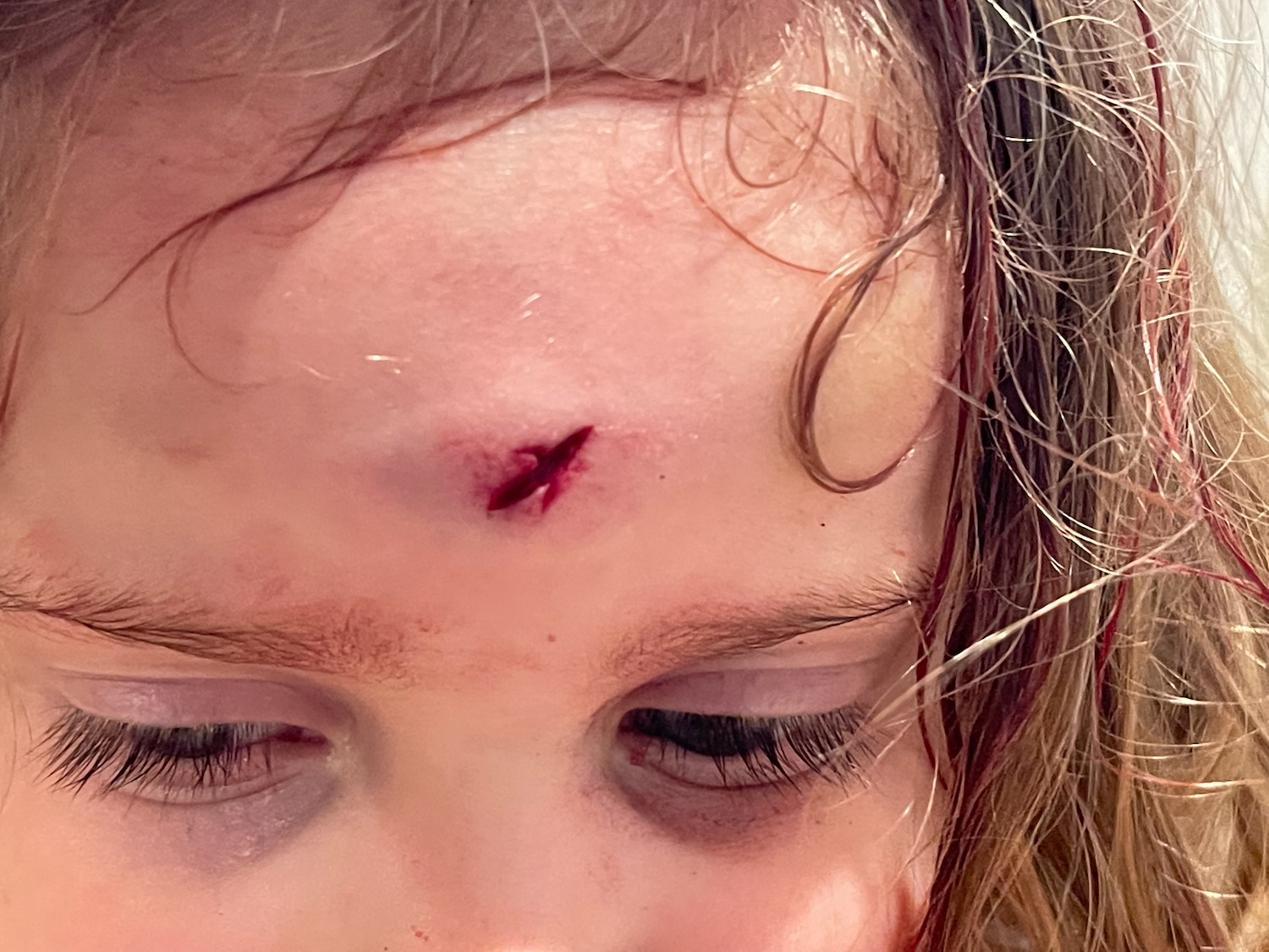a close up of a wound on a child's forehead