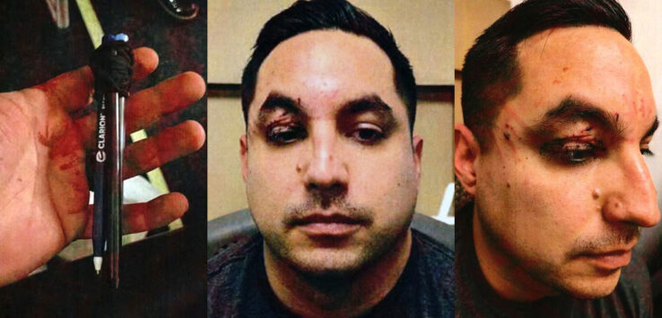 a collage of a man with a bruised eye