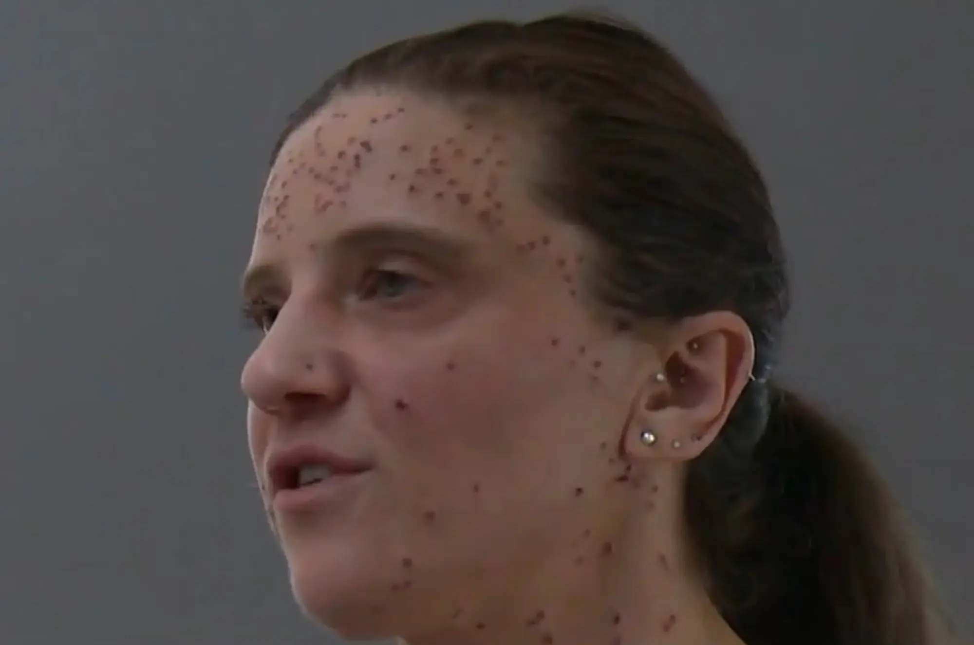 a woman with red dots on her face