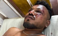 Air India Crash Survivor