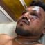 Air India Crash Survivor