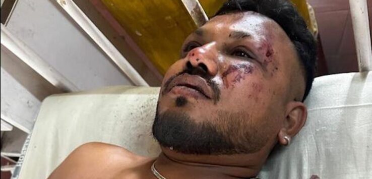 Air India Crash Survivor